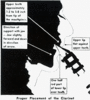 positioning of mouthpiece /teeth