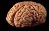 A Brain