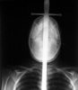 An X-ray