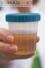 Cup of clean urine