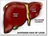 Liver Transplant